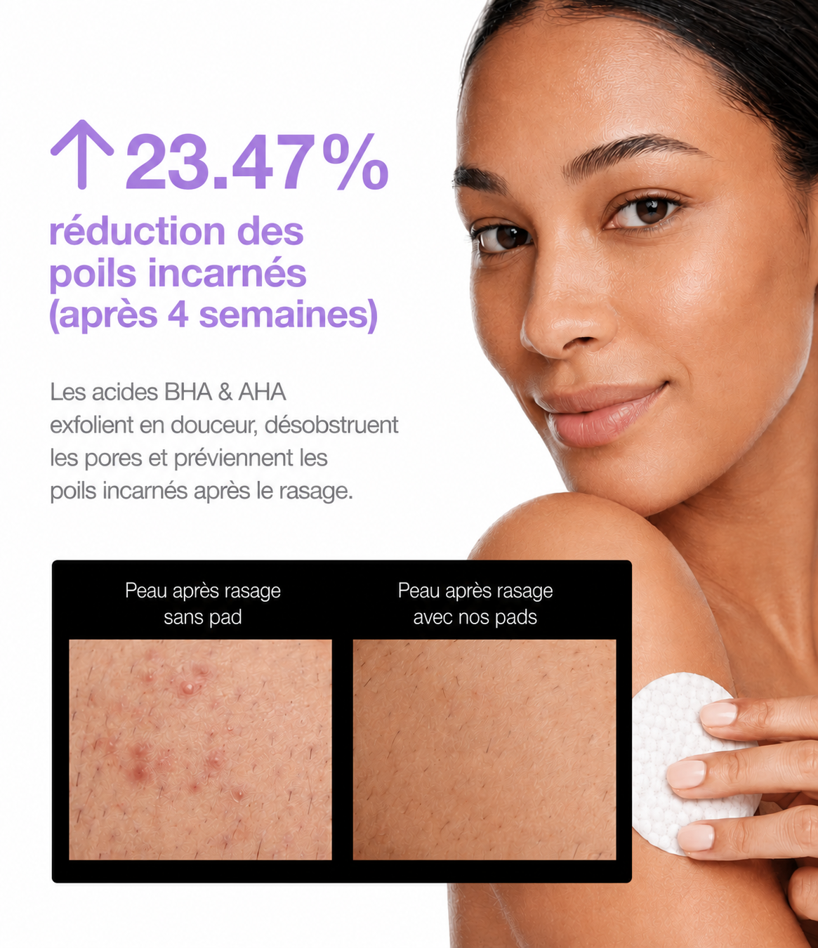 Pads Anti Poils Incarnés